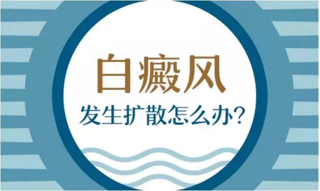 白癜風(fēng)繼續(xù)擴(kuò)散怎么辦